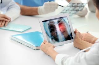 Imagerie médicale : les centres Evesio vont accueillir un fonds britannique